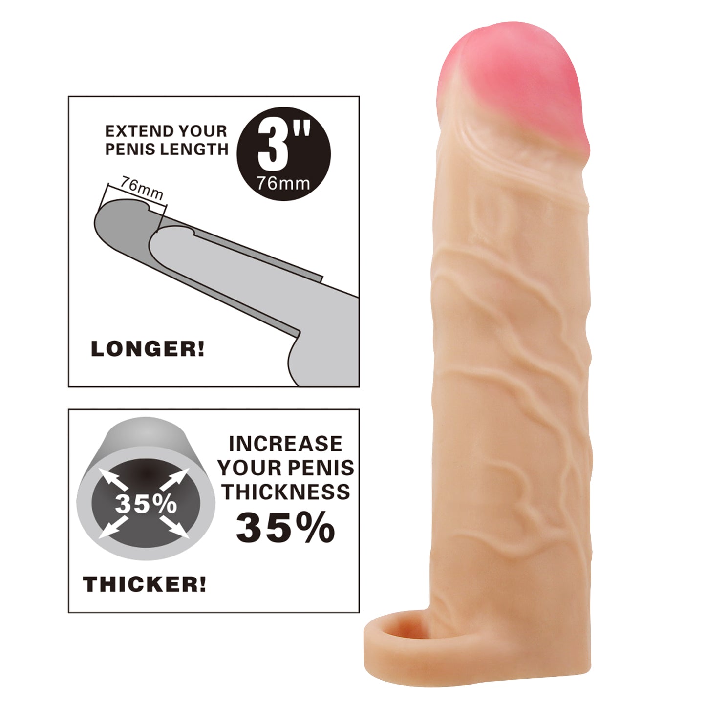EXTENSION GERD